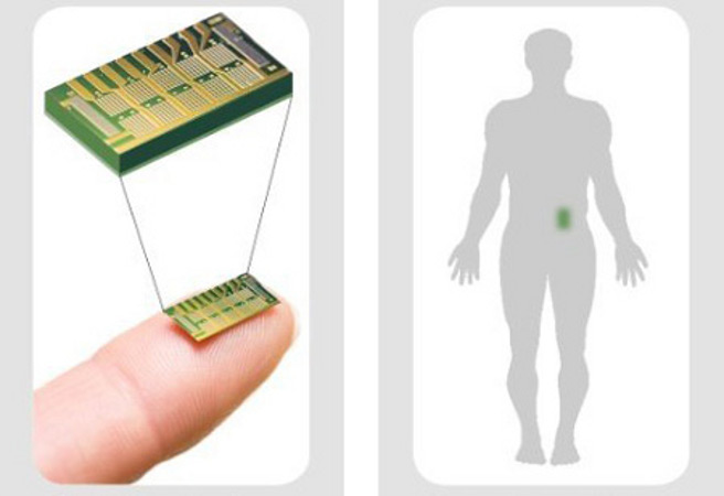 Специалистите от  MicroCHIPS успешно проведоха тест върху имплантирано в хора програмируемо устройство