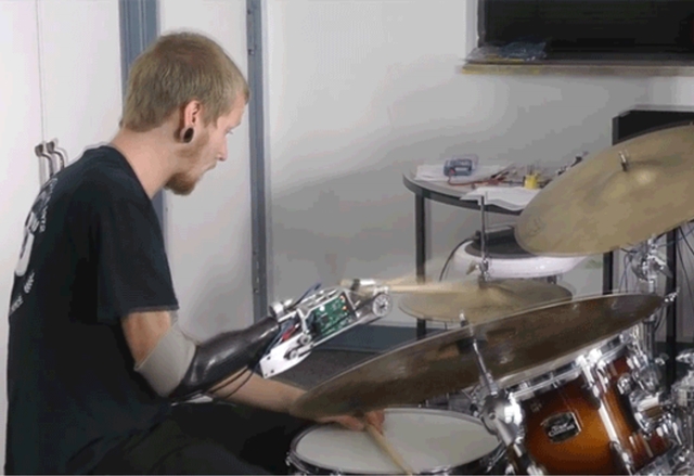 Еднорък барабанист продължава да свири с впечатляваща роботизирана протеза