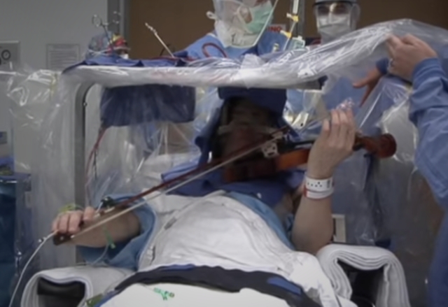 Цигулар свири по време на мозъчна хирургия