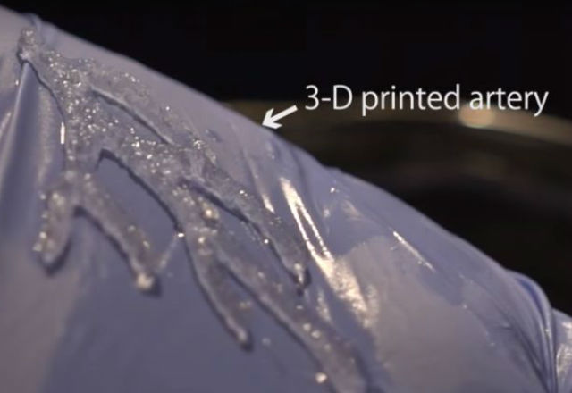 Обикновени 3D принтери печатат кръвоносни съдове