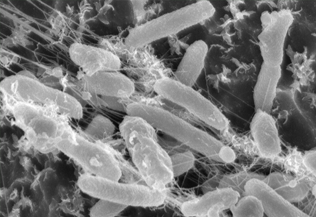 Японски учени откриха нова бактерия, която  се храни с пластмаса