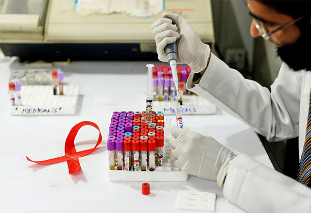 Британски учени твърдят, че са разработили ново успешно лечение на СПИН