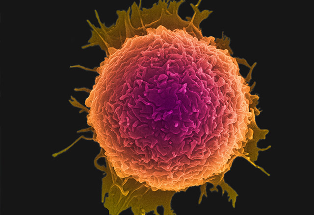 Нанодискове ще учат тялото ви да се справя с раковите клетки