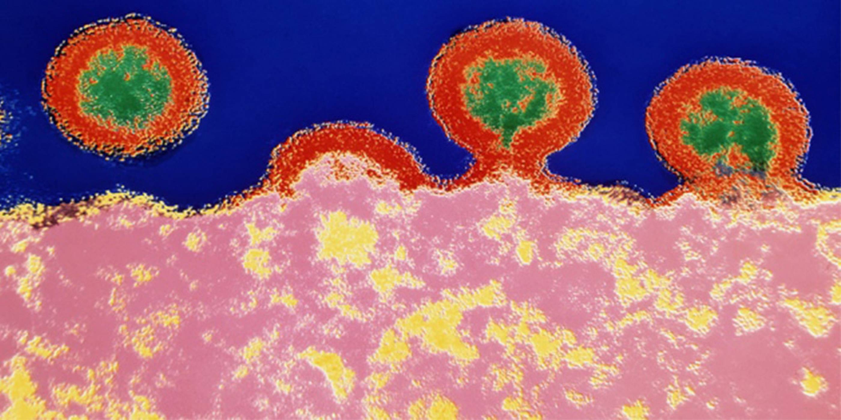 Учени успяха да маркират "спящи" HIV-инфектирани Т-клетки, за да лекуват СПИН