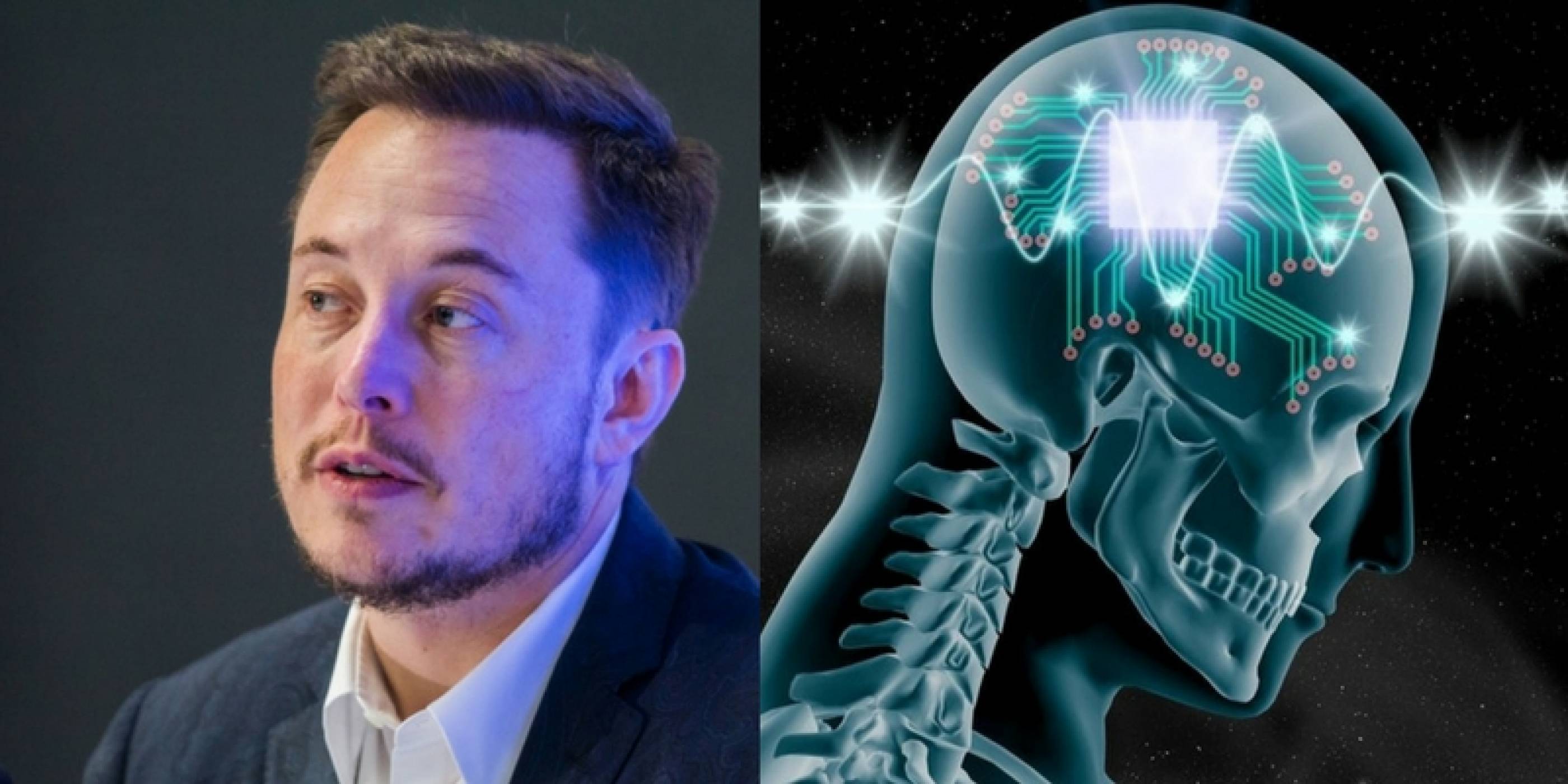 Neuralink на Илон Мъск иска да надникне в човешкия мозък
