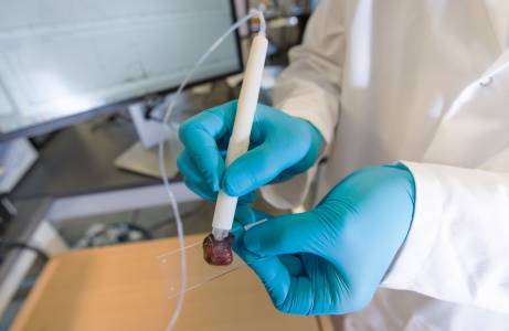 Устройство под формата на химикалка ще диагностицира рак за десет секунди