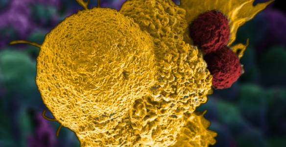 Модифициран вирус се бори с рака и туморите