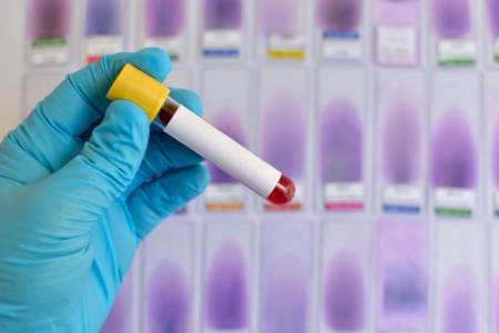 Ваксина против ХИВ ще се тества върху хора в клинични условия