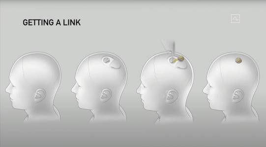 Дискусия в Twitter относно Neuralink отново повиши напрежението