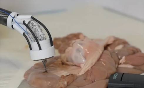 Имплантиран 3D биопринтер може да поправя наранена тъкан (ВИДЕО)